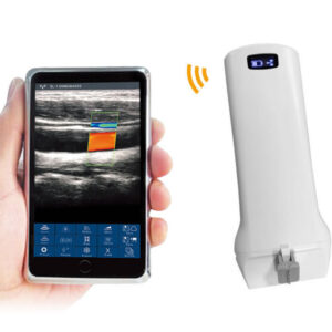 6L / 6P Linear palm doppler ultrasound scanner
