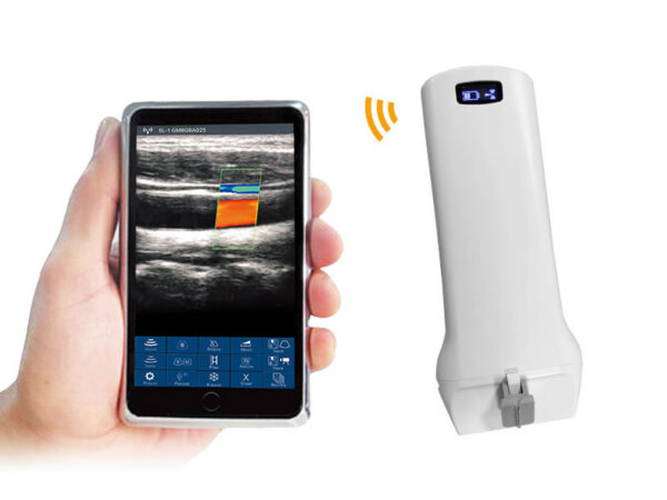6L / 6P Linear palm doppler ultrasound scanner